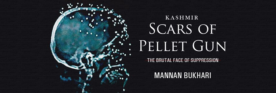 KASHMIR Scars of Pellet Gun By Mannan Bukhari